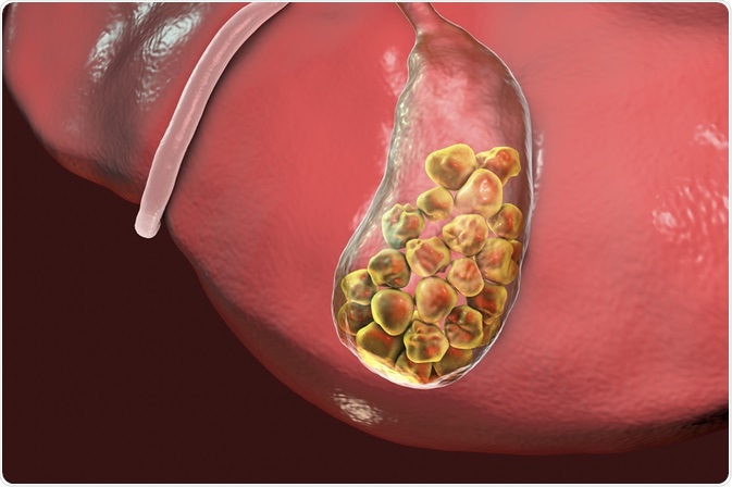 Laser Stone and Prostate Treatment in Camp