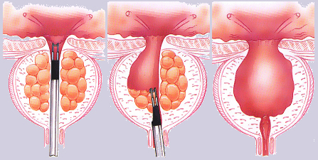 Urologist in Hadapsar