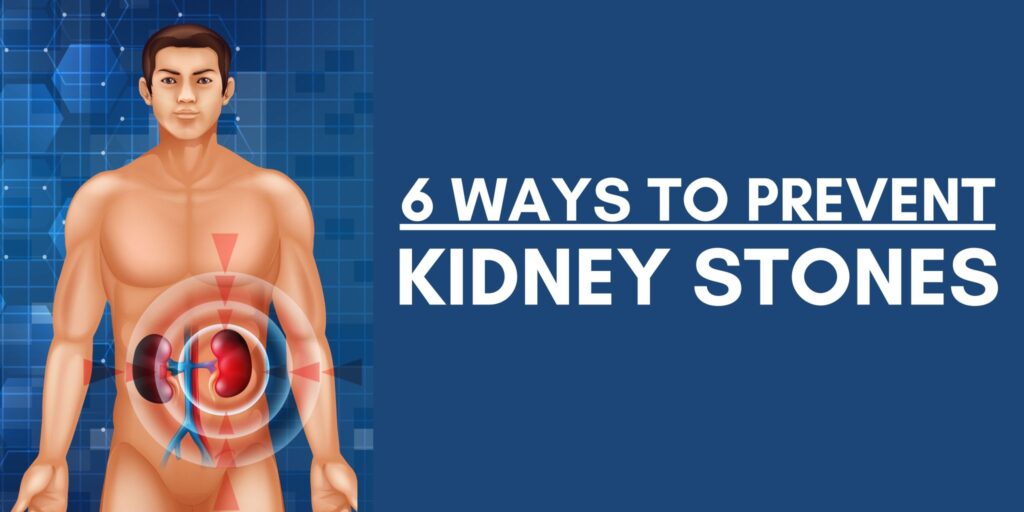 6 Ways to Prevent Kidney Stones